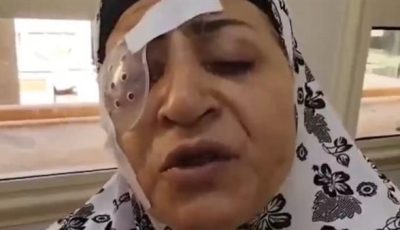 سيدة فقدت بصرها بسبب خطأ طبي بمستشفى رمد المحلة: الدكاترة كانوا بيتعلّموا في عيني وضيعوني
