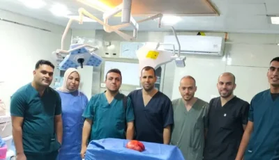 فريق طبي بمستشفى كفر الشيخ العام ينجح في استئصال ورم مُعقد من بطن مريض (صور)
